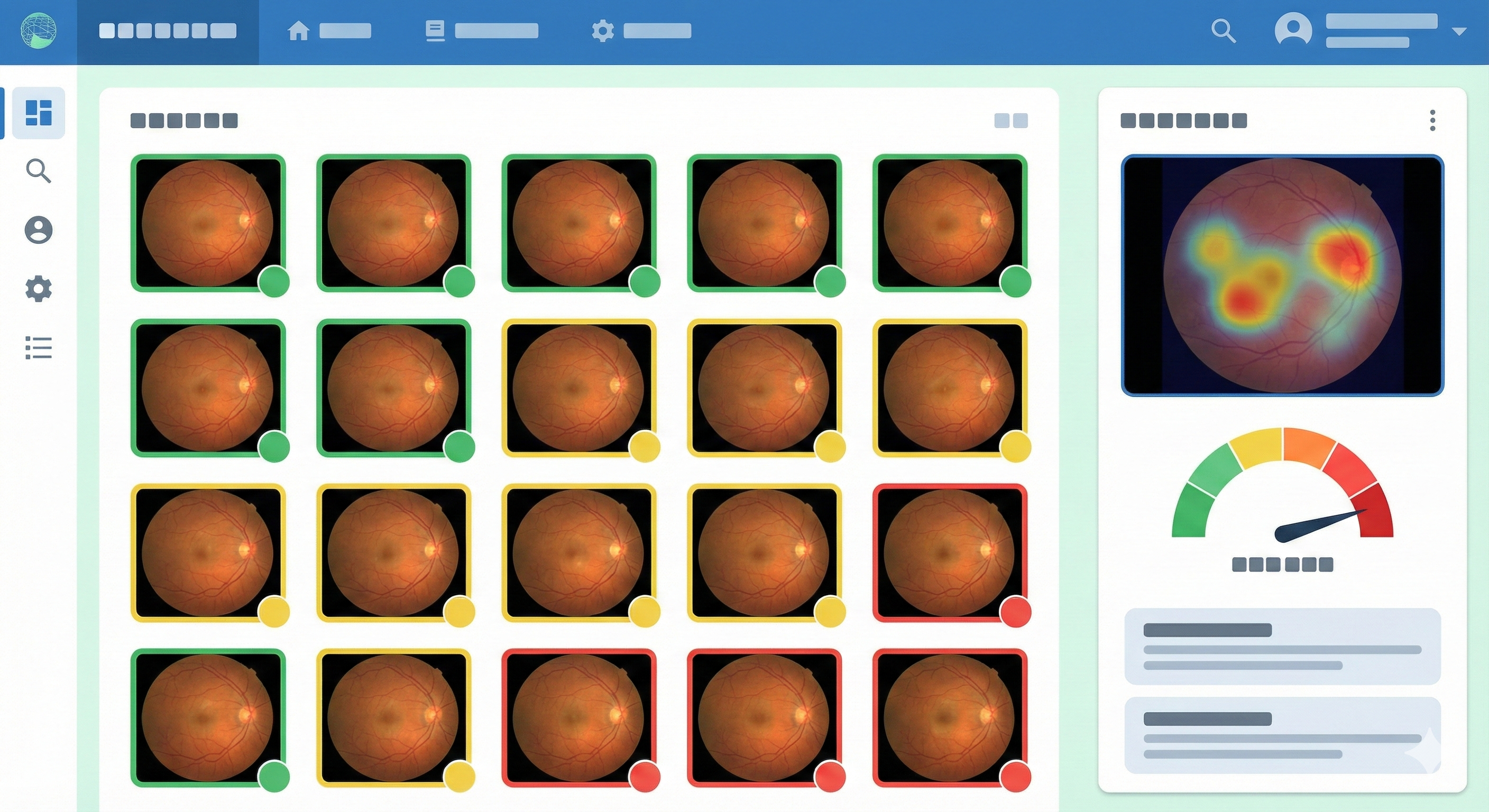 AI Eye Disease 